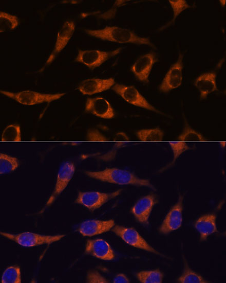 Anti-SMAP1 Antibody Anti-SMAP1 Antibody