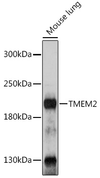 Anti-TMEM2 Antibody