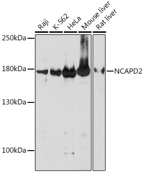Anti-NCAPD2 Antibody