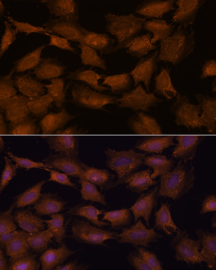 Anti-NCAPD2 Antibody Anti-NCAPD2 Antibody