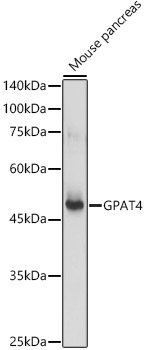 Anti-GPAT4 Antibody