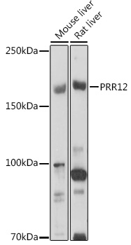 Anti-PRR12 Antibody