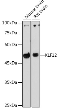 Anti-KLF12 Antibody