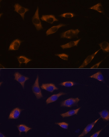 Anti-FSTL4 Antibody Anti-FSTL4 Antibody