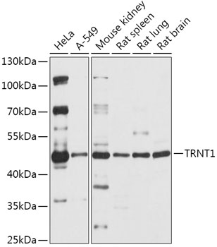 Anti-TRNT1 Antibody