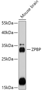 Anti-ZPBP Antibody