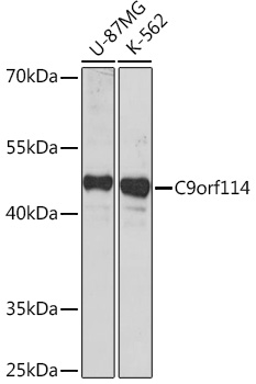 Anti-SPOUT1 Antibody