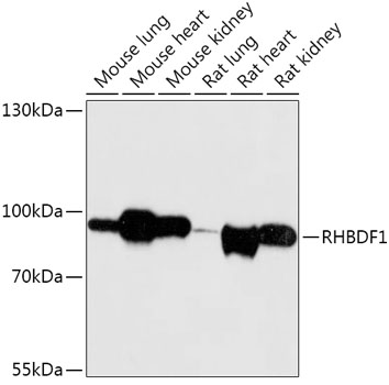 Anti-RHBDF1 Antibody