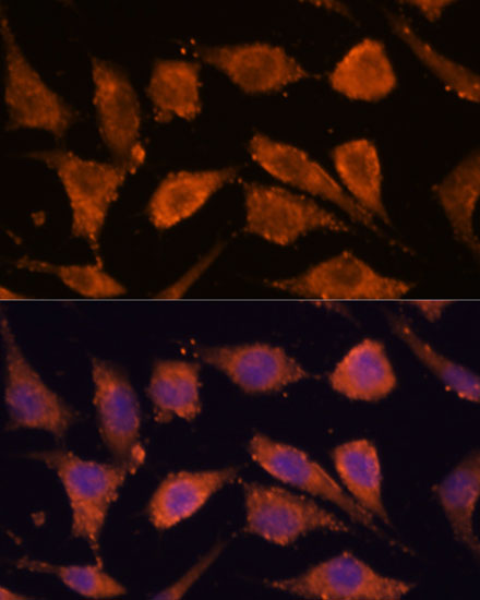 Anti-RHBDF1 Antibody Anti-RHBDF1 Antibody