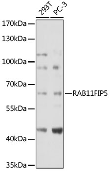 Anti-RAB11FIP5 Antibody