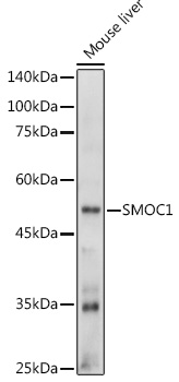 Anti-SMOC1 Antibody