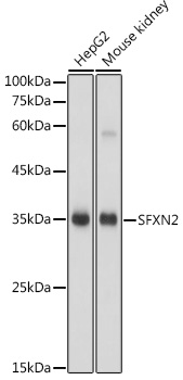 Anti-SFXN2 Antibody