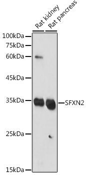 Anti-SFXN2 Antibody Anti-SFXN2 Antibody