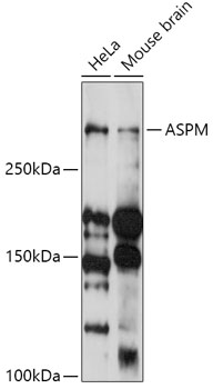 Anti-ASPM Antibody