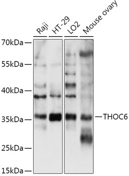 Anti-THOC6 Antibody