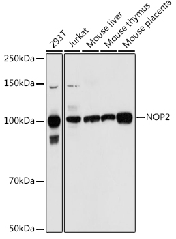 Anti-NOP2 Antibody