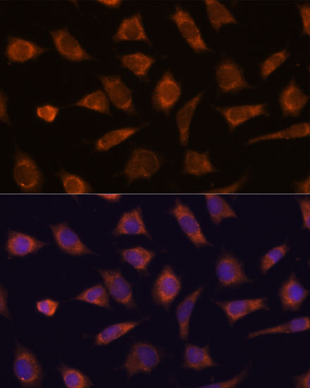 Anti-CAMSAP1 Antibody Anti-CAMSAP1 Antibody