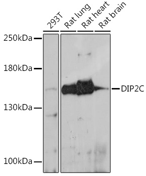Anti-DIP2C Antibody