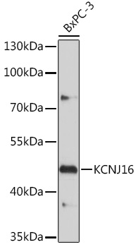 Anti-KCNJ16 Antibody