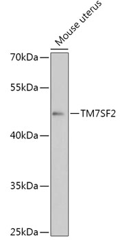 Anti-TM7SF2 Antibody