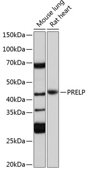 Anti-PRELP Antibody