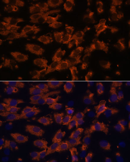 Anti-PRX Antibody Anti-PRX Antibody