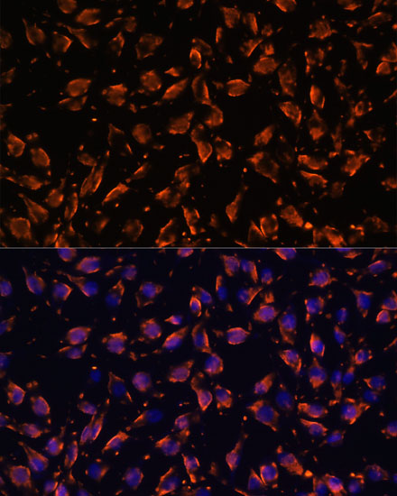 Anti-PRX Antibody Anti-PRX Antibody