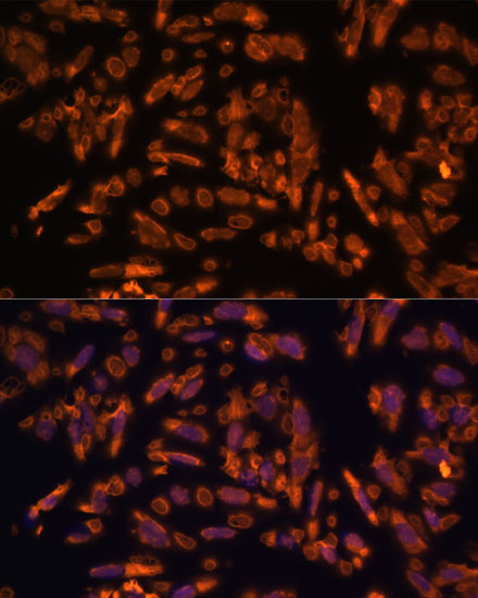 Anti-PRX Antibody Anti-PRX Antibody