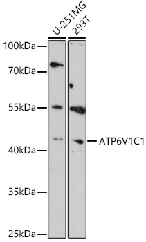 Anti-ATP6V1C1 Antibody