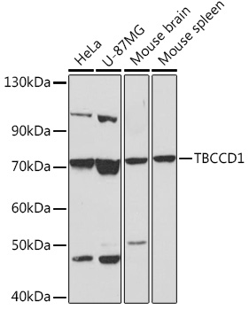 Anti-TBCCD1 Antibody