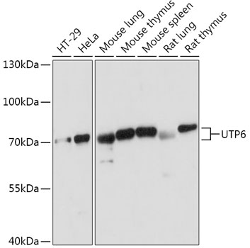 Anti-UTP6 Antibody