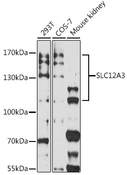 Anti-SLC12A3 Antibody