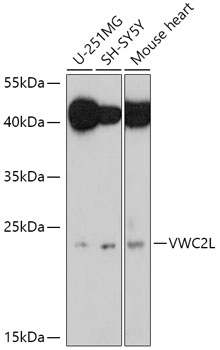 Anti-VWC2L Antibody