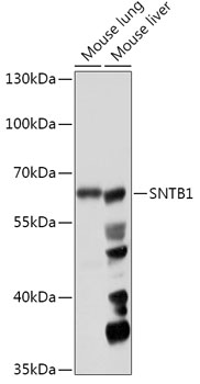 Anti-SNTB1 Antibody