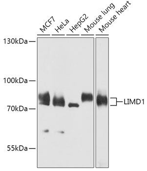 Anti-LIMD1 Antibody