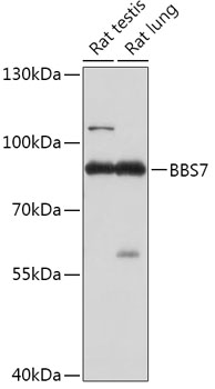 Anti-BBS7 Antibody