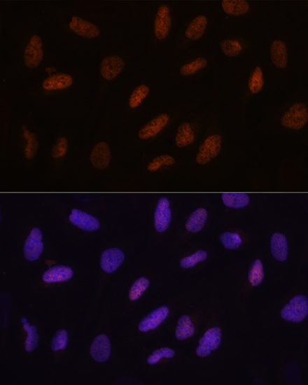 Anti-TET3 Antibody Anti-TET3 Antibody