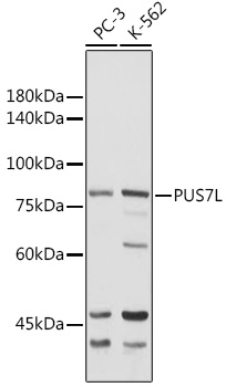 Anti-PUS7L Antibody