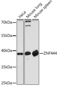 Anti-ZNF444 Antibody