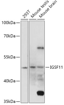 Anti-IGSF11 Antibody