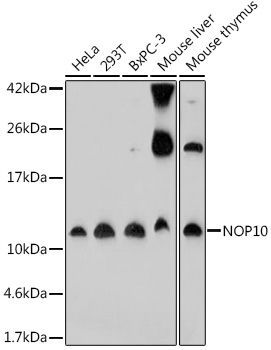 Anti-NOP10 Antibody