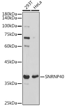 Anti-SNRNP40 Antibody