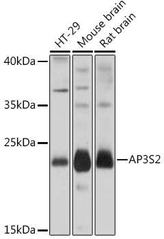 Anti-AP3S2 Antibody