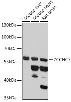 Anti-ZCCHC7 Antibody