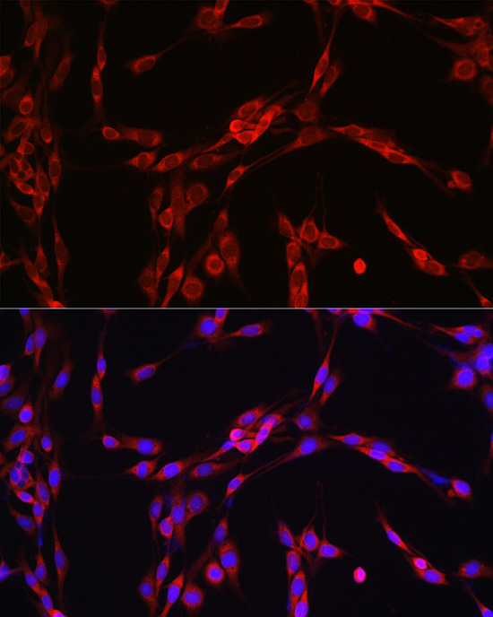 Anti-SEC61B Antibody Anti-SEC61B Antibody