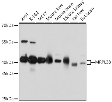 Anti-MRPL38 Antibody