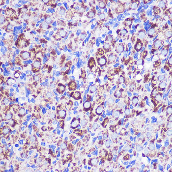 Anti-MRPL38 Antibody Anti-MRPL38 Antibody