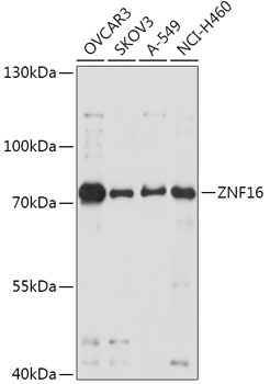 Anti-ZNF16 Antibody