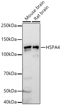 Anti-HSPA4 Antibody Anti-HSPA4 Antibody