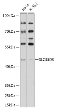 Anti-SLC35D3 Antibody